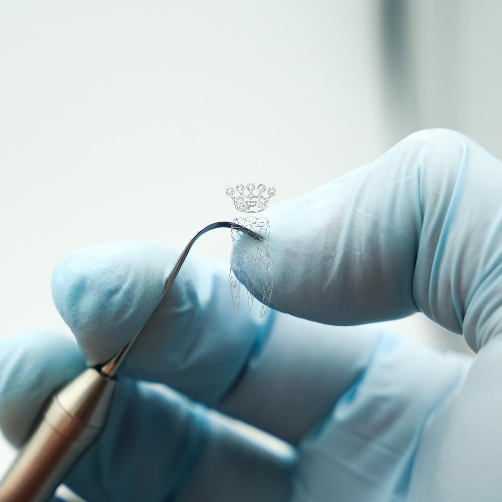 Spatula TitanFlex 1.6mm LiquidSteel