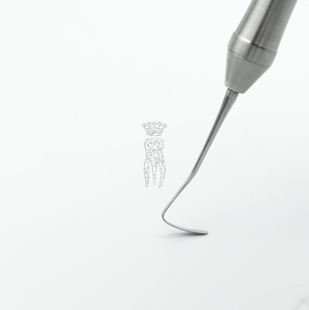 Spatel TitanFlex 2.0mm LiquidSteel